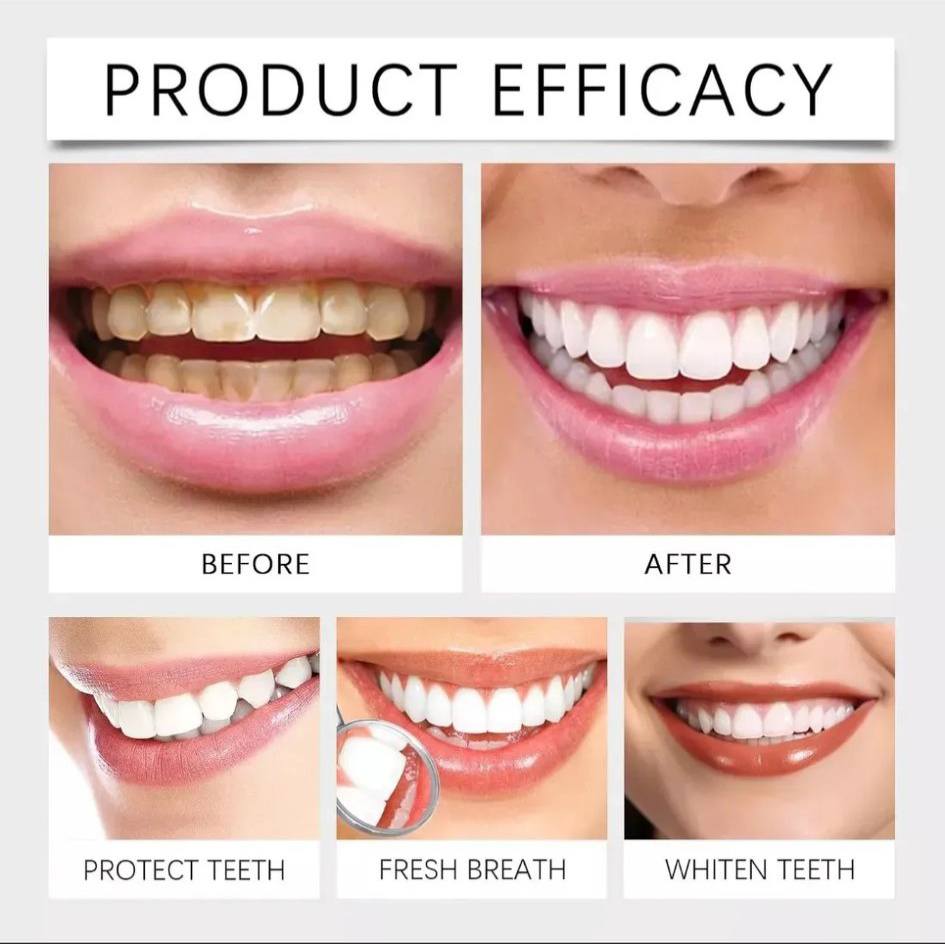 𝗣𝗔𝗦𝗧𝗔 𝗗𝗘 𝗗𝗜𝗘𝗡𝗧𝗘𝗦 𝗗𝗘 𝗛𝗜𝗗𝗥𝗢𝗫𝗜𝗔𝗣𝗔𝗧𝗜𝗧𝗔 𝗡𝗔𝗡𝗢 𝟳.𝟱%